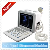 Ultrasound Machine cost & ultrasonic scanner price