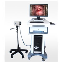 high-tech digital electronic colposcope