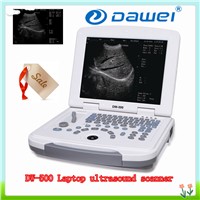 CE Pregnancy scanner ultrasound with DW-500 12inch LED pc ultrasound scanner