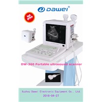 China portable ultrasound machine price for DW-360 pregnancy scanner ultrasound