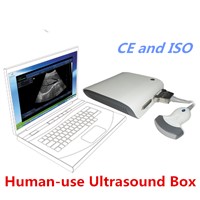 Human&Veterinaria Ultrasound BOX/BOX ultrasonic machine/echo box scanner/ultra sound scan Box/Ubox