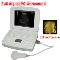 PC+3D full-digital usg/ultrasonic machine/echo scanner/ultra sound scan/notebook echo/sonography
