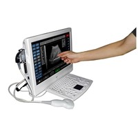 Sonostar 18" high resolution touch screen portable color doppler machine low price UTouch-8