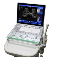 Sonostar 2016 hot supper quality portable ultrasound machine with low price SS-8