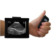 Sonostar Best Price Veterinary Ultrasound Cheapest Portable Ultrasound Machine V2