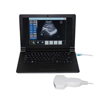Sonostar Laptop PC based high quality medical cheapest portable ultrasound machine for sale UBook-8