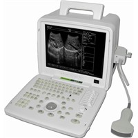 Sonostar high quality portable black and white 12 inches LCD screen ultrasound machine sale SS-4