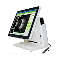 Sonostar Full Digital Portable Ophthalmic A/B Ultrasound Scanner Machine SAB-500