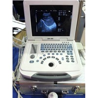 DW-580 laptop ultrasound scanner & medical ultrasound equipment
