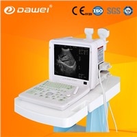 Low Price Portable Ultrasound Machine and china portable ultrasound machine