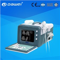 Hot Sale Cheap Medical 2D Portable Ultrasound Machine Price for Pregnancy DW-3101A