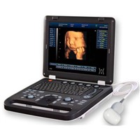 3D digital laptop ultrasound scanner