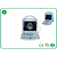 Fully Digital type b Laptop Ultrasound Scanner with duable power supply mode
