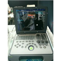 Doppler Ultrasound Equipment Type portable doppler ultrasound machine