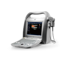 Hottest Medical Equipment 4D Portable Color Doppler Ultrasound