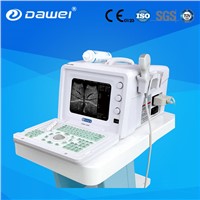 portable medical laboratory diagnostic ultrasound equipment for b ultrasound diagnostic system