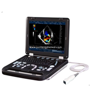 Diagnostic Equipment 3D 4D Color Doppler Ultrasound