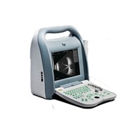 A/B Mode Ophthalmological Ultrasound Scanner for Professional Eye Check Scanner ODU8