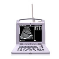 Digital Portable Ultrasound Scanner (Windows Based, 128 Element)