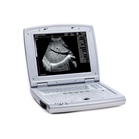 KX5000 High Quality Portable Medical Scanner Human Ultrasound Scanner