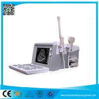 Portable Ultrasound Scanner Ultrasound Diagnostic Equipment