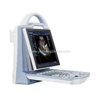 Laptop 3D Color Doppler System Ultrasound Scanner (YSD330)