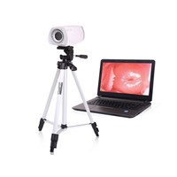 PL-9800 Medical Equipment Portable Digital Camera Vaginoscope Colposcope