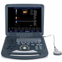 Full-Digital 2D Notebook Color Doppler System with Factory Price