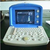 Human Use Digital Portable Ultrasound Scanner ATNL51353A