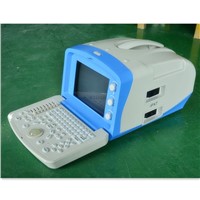 Low-Cost Portable Ultrasound Scanner (CE & ISO)/Factory-Support USG Echo Machine