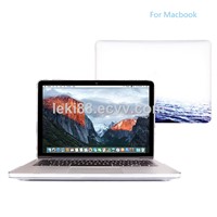Print Plastic Pattern Hard Shell Cover Apple Macbook Pro 12 