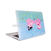New Pink Pig Young Girl Print Abstract Design, PC Case for Macbook Air/Pro 11'12'13'15inch, for Notebook Case
