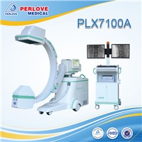 Angiography C Arm System PLX7100A X-Ray Equipment