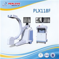C Arm Equipment PLX118F for Foreign Matter Removal