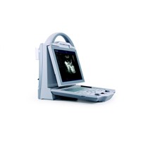 Medical/ Hospital Equipmentportable B/W Ultrasound Scanner for Human (KX5600)