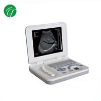 Pl-3018 Digital Laptop Ultrasound Scanner