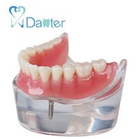 Danter 2 Implants Restoration Sillones Dental Model Implant Dental Tool for Training