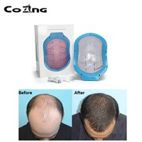Portable Bald Laser Head Hair Growth Cold Laser Treatment Helmet for Home Remedy