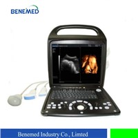 Hotsell Portable 4D Color Doppler Ultrasound BENE-3V