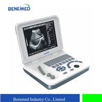 Ultra Slim Notebook Ultrasound Scanner Black & White BW-6 with 10.4 Inch LED Screen & Battery