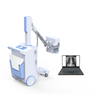 DIGITAL MOBILE X-RAY MACHINE PLX5100