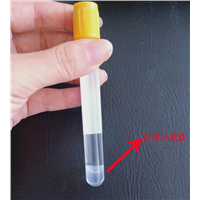 Classification of Vacuum Blood Collection Tubes, Principle & Function of Additives