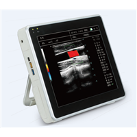 Ultrasound USG-VT Eye (Touch Screen)