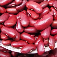 Red, White & Light Speckled Kidney Beans