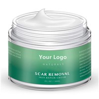 OEM/ODM Private Label Whitening Scar Removal Face Cream Anti Acne Cream Skin