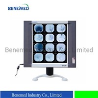 Ultraslim LED X-Ray Film Viewer Single Section Medical Devices