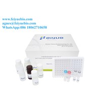 Human S100B(Protein S100-B) ELISA Kit