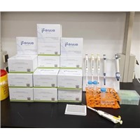 Human CYP3A4(Cytochrome P450 3A4) ELISA Kit