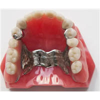 Dental Removable Vatallium Metal Framework with Partial Acrylic Resin Teeth(CCP)