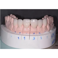 Cad-Cam Temporaries (PMMA) China Dental Lab